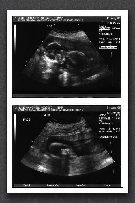 sonogram-2006-08-11