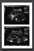 sonogram-2006-08-11