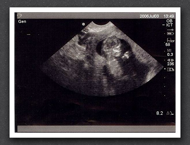 sonogram-2006-07-03