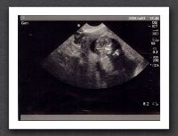 sonogram-2006-07-03