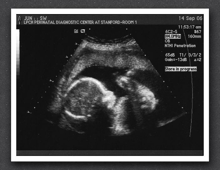 sonogram-2006-09-14-2