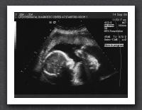 sonogram-2006-09-14-2