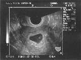 sonogram-2003-02-18.jpg