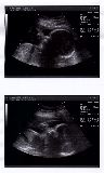 sonogram-2003-07-17.jpg