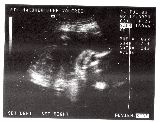 sonogram-2003-07-24.jpg