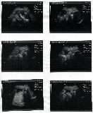 sonogram-2003-08-04.jpg