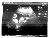 sonogram-2003-09-04.jpg