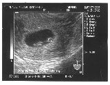 sonogram-2003-02-27.jpg