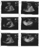 sonogram-2003-03-24.jpg