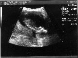 sonogram-2003-04-17.jpg