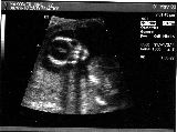 sonogram-2003-05-01.jpg