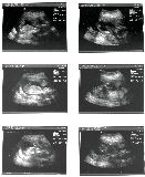 sonogram-2003-05-07-a.jpg