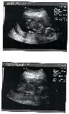 sonogram-2003-05-07-b.jpg