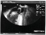 sonogram-2003-05-08.jpg