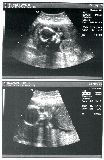 sonogram-2003-05-22.jpg